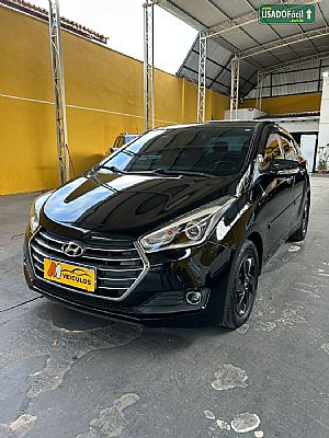 HB20S Sedan Premium 1.6 Automático Flex