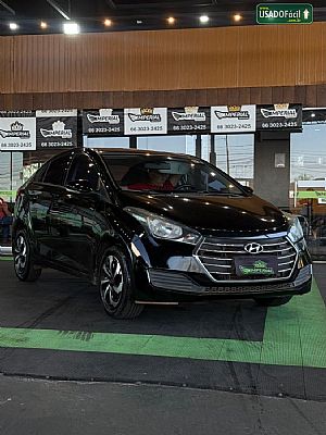 Hyundai Hb20S 2017