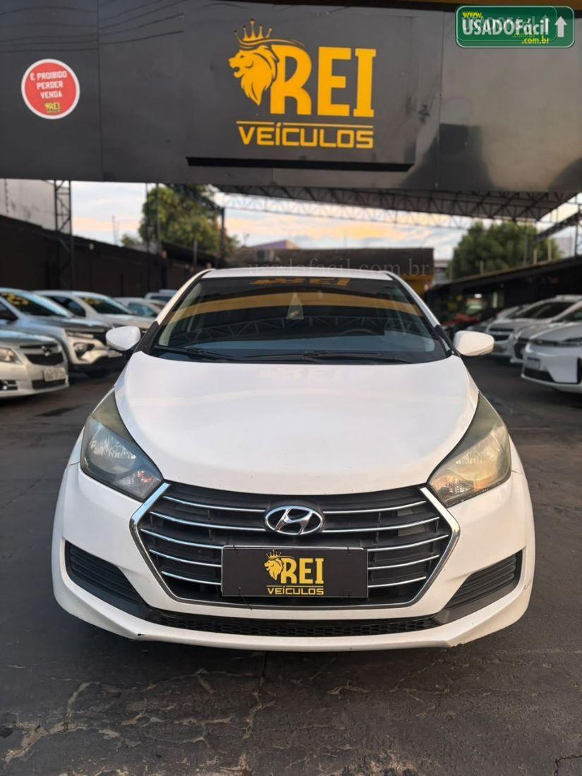 HYUNDAI HB20S Sedan Ocean 1.6 Automático Flex 2017/2017 — foto 2 de 12