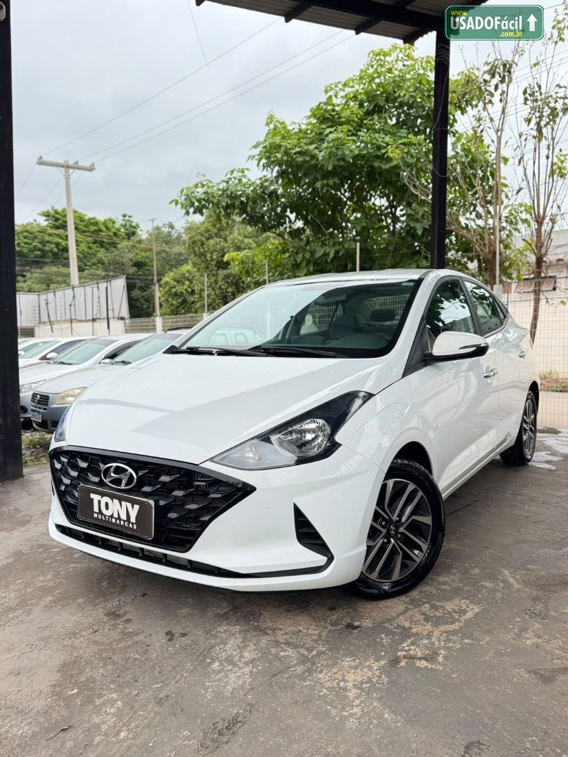 Hyundai HB20S Sedan Platinum Plus 1.0 Turbo Automático Flex 2022/2022 — foto 3 de 13
